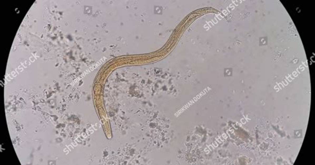Microscope to See Parasites