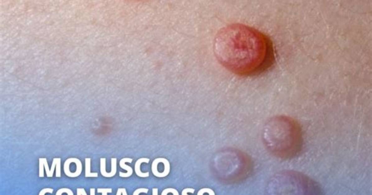 Molusco