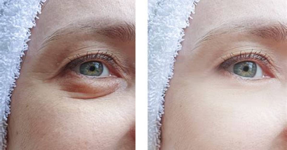 My Secret to Smooth Under-Eyes Is Laneige’s $32 Glowy Makeup Serum