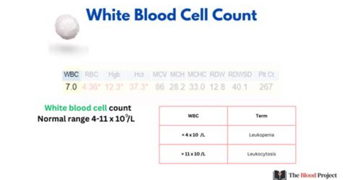 Normal Wbc Count