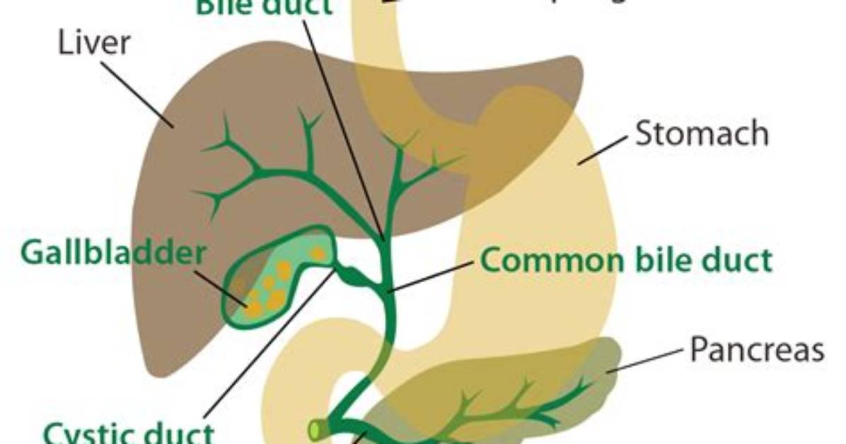 On Common Bile Duct?