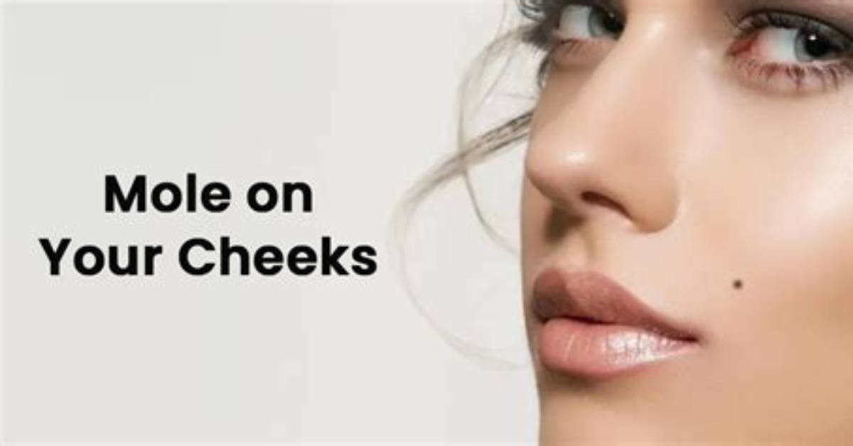 On Left Cheek Mole?
