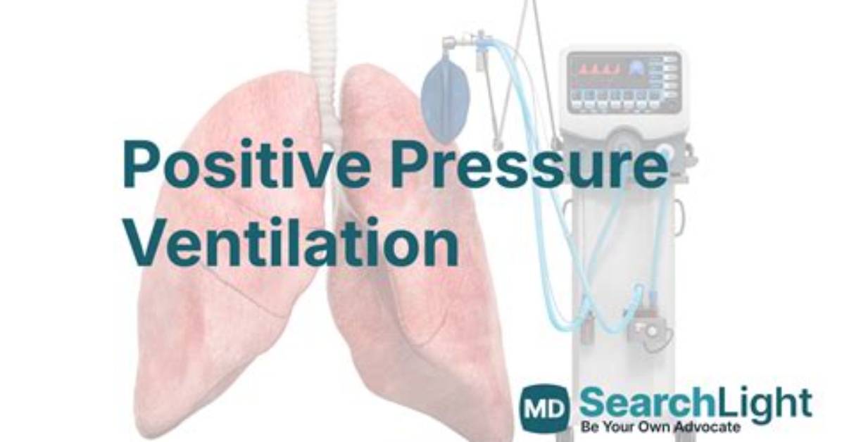 On Positive Pressure Ventilation?