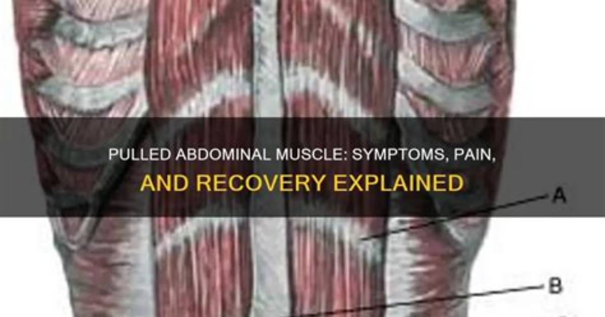 Pulled Abdominal Muscle