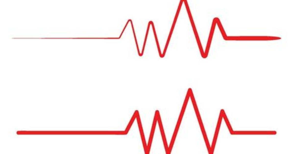Pulse