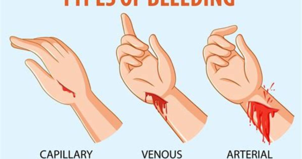 Quick Answer: Which Description Defines a Bleed in an Illustrator Cc Document?