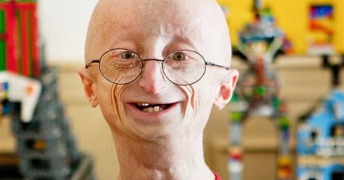 Sam Berns