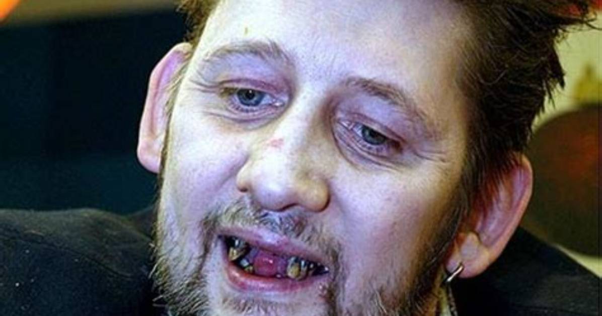Shane Macgowan Net Worth