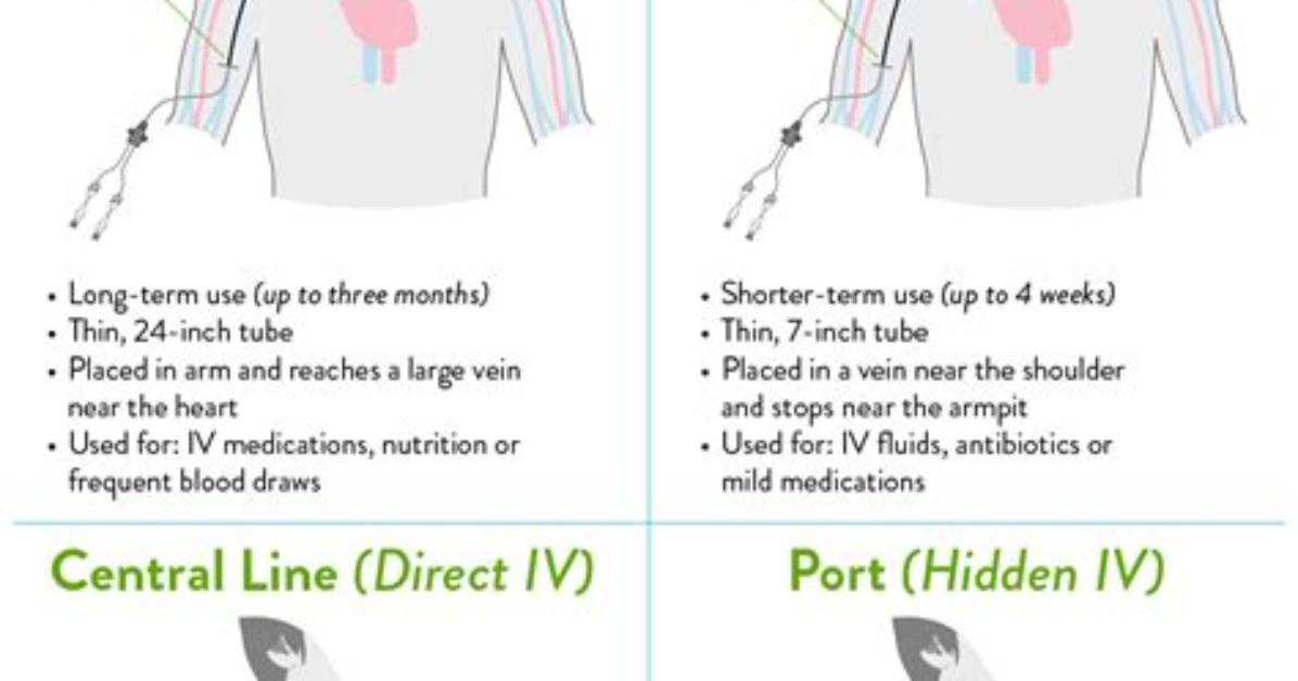 Should a Picc Line Be Flushed with Heparin?