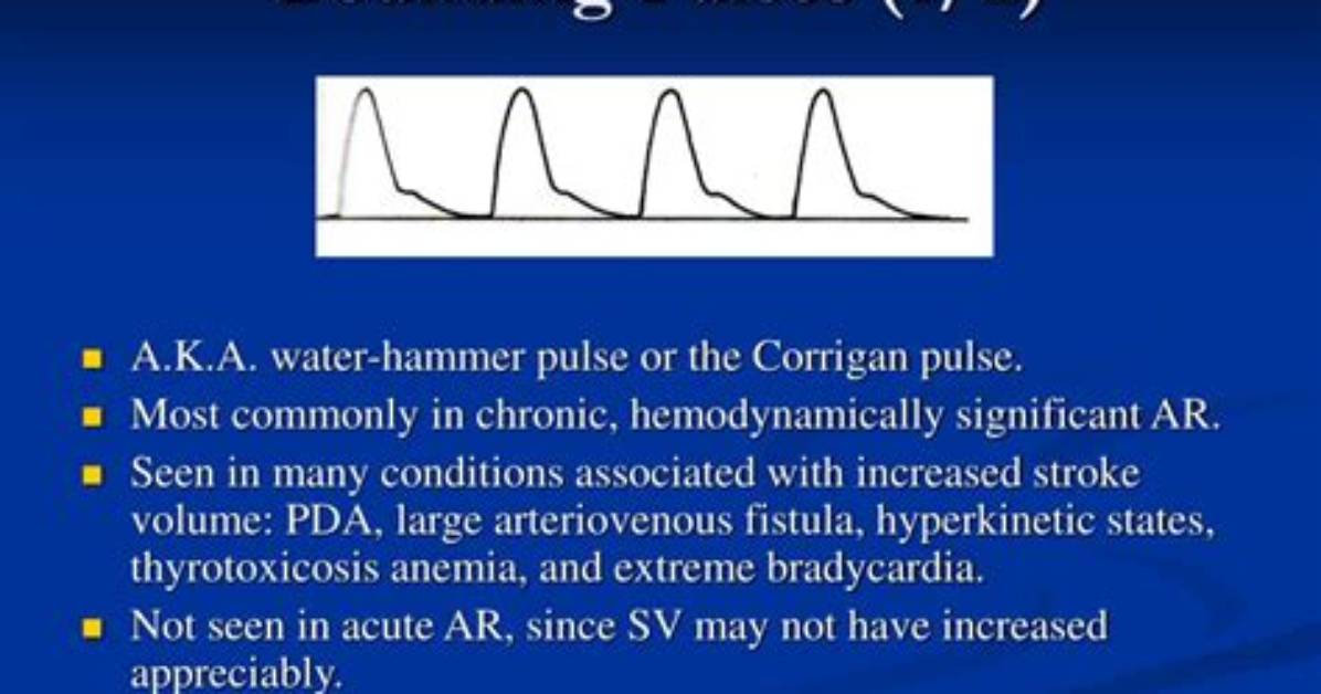 Should a Pulse Be Bounding?