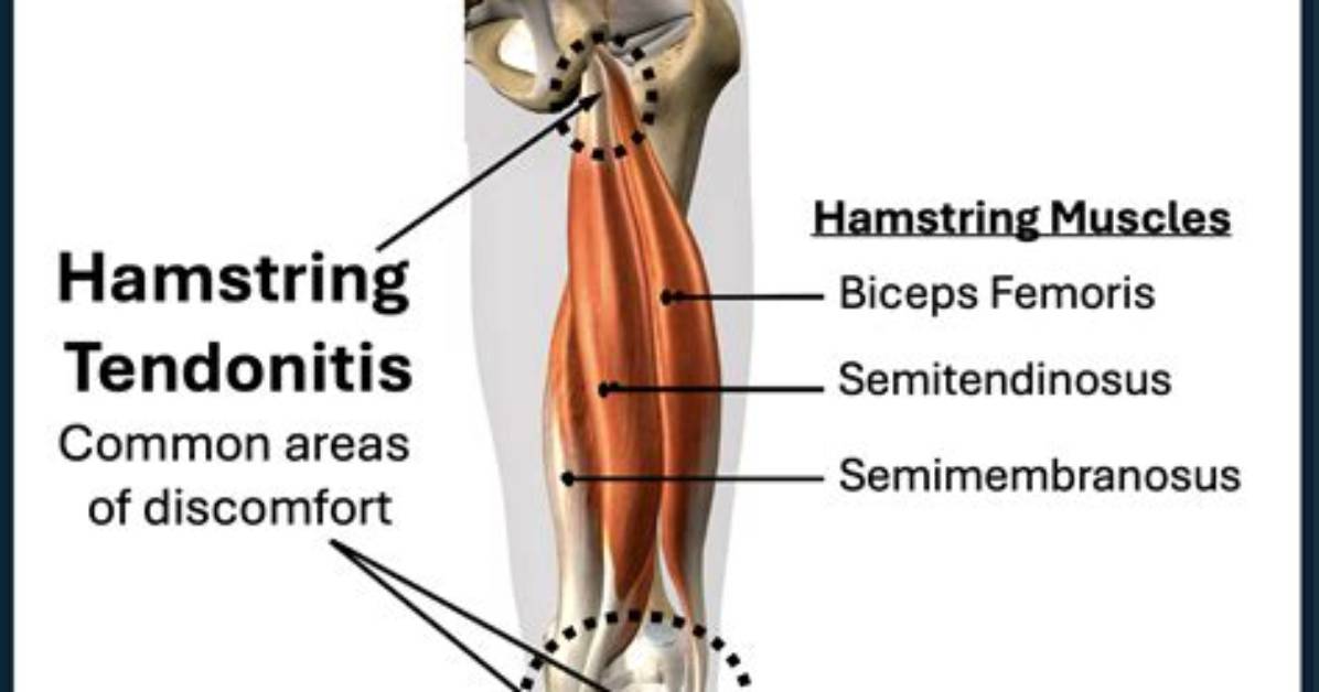 Should Hamstring Be Trained?
