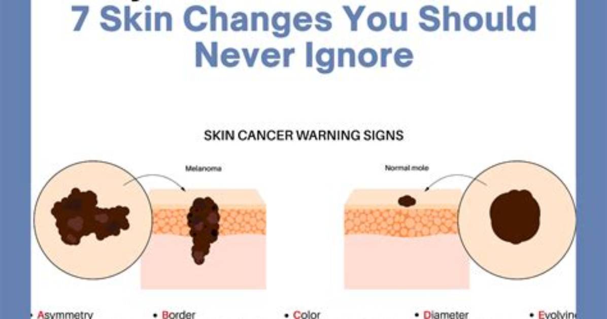Should I Commit Cosmetic Changes?