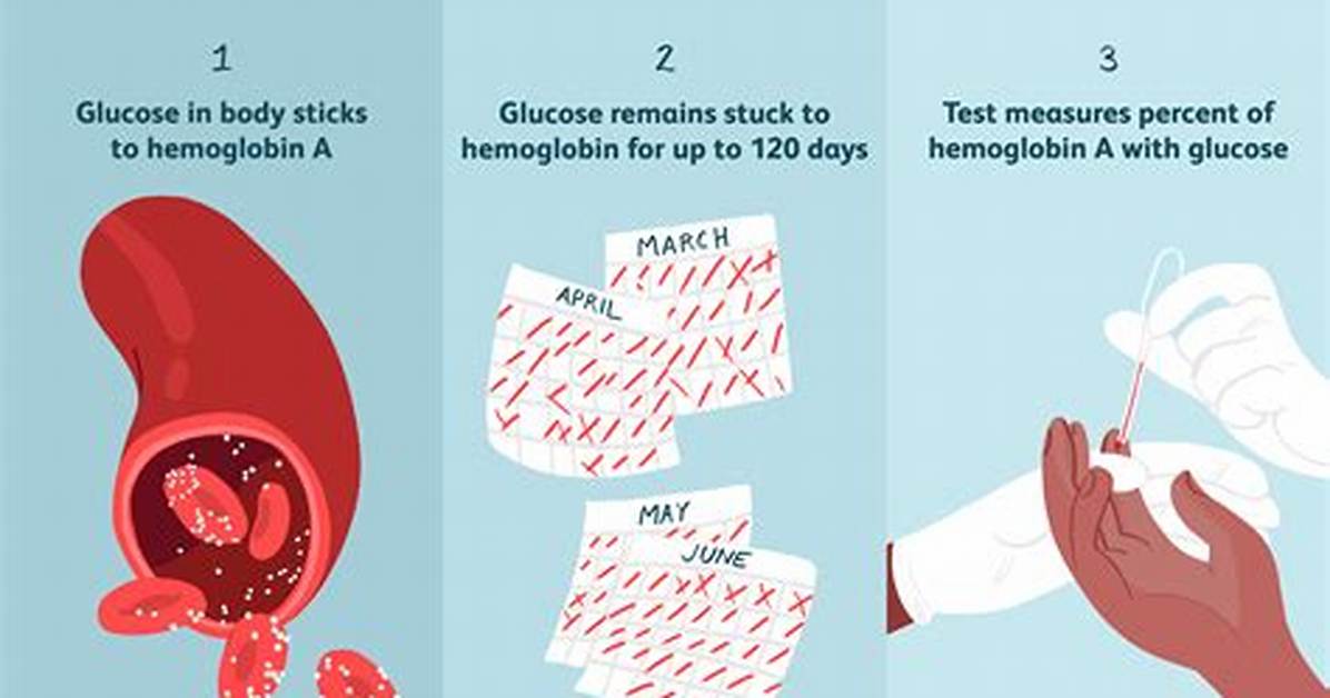 Should I Fast for Hemoglobin A1C Test?