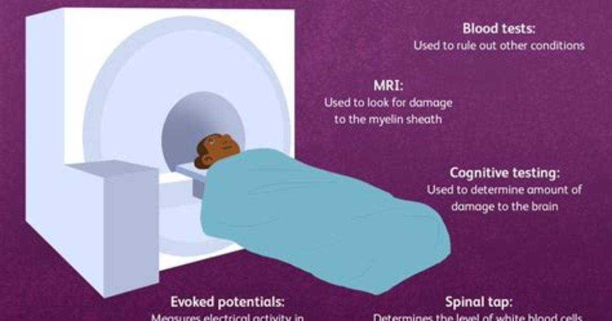Should I Get Tested for Multiple Sclerosis?