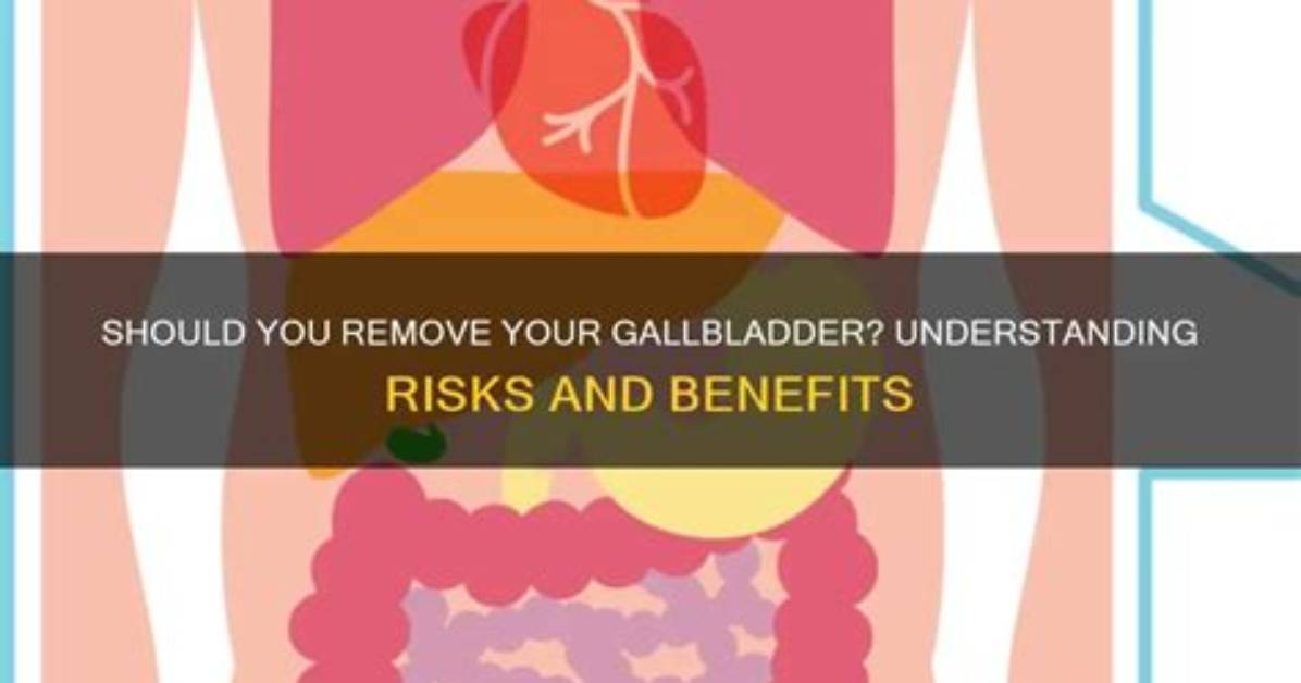 Should I Remove My Gallbladder?
