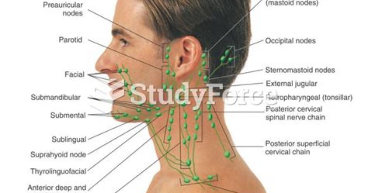 Should Lymph Nodes Be Palpable?