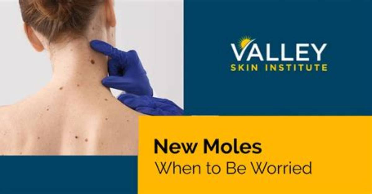 Should Moles Hurt When Touched?