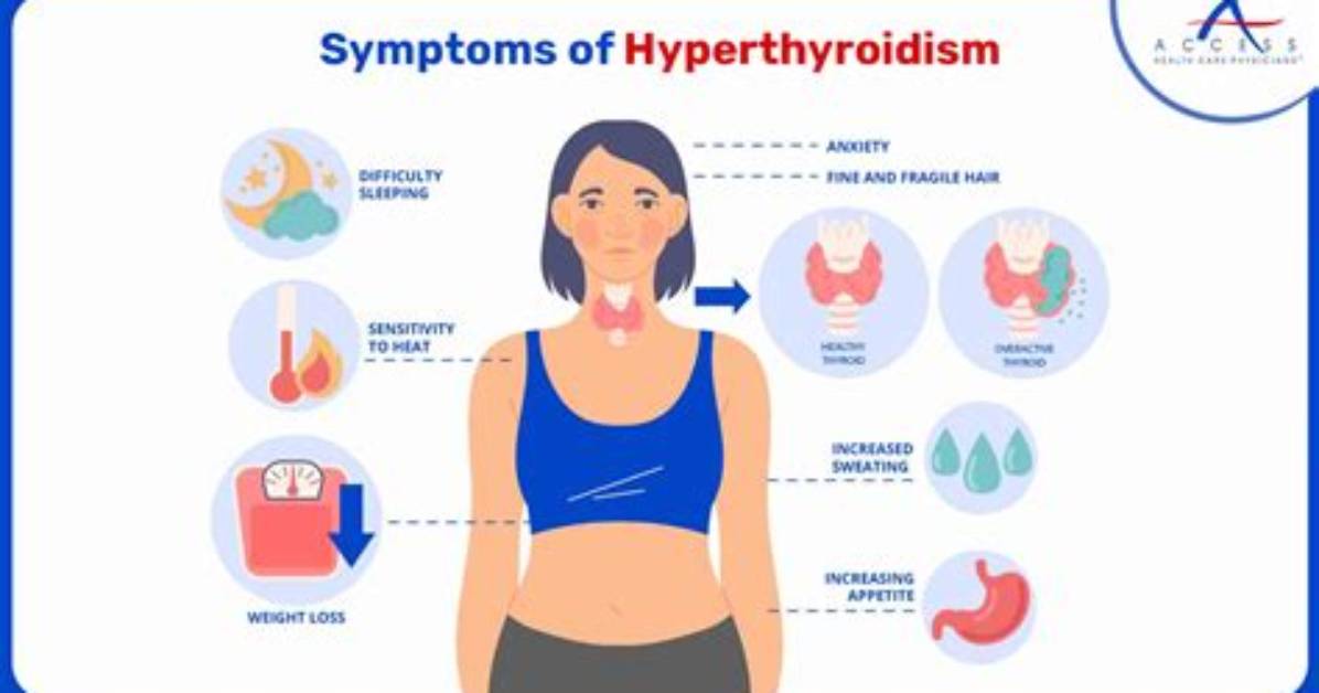 Should Someone with Hyperthyroidism Take Iodine?