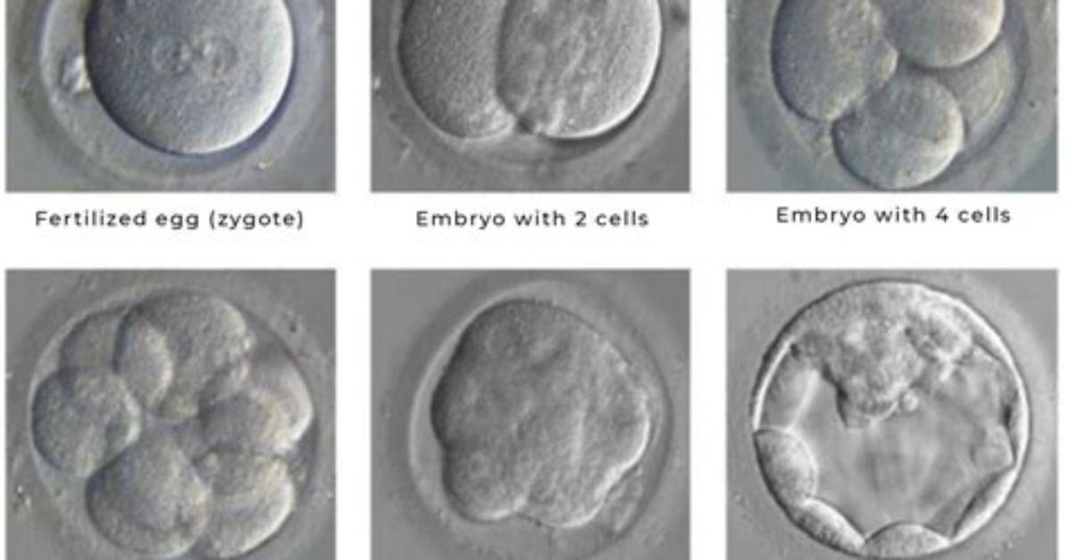 Should We Transfer Two Embryos?