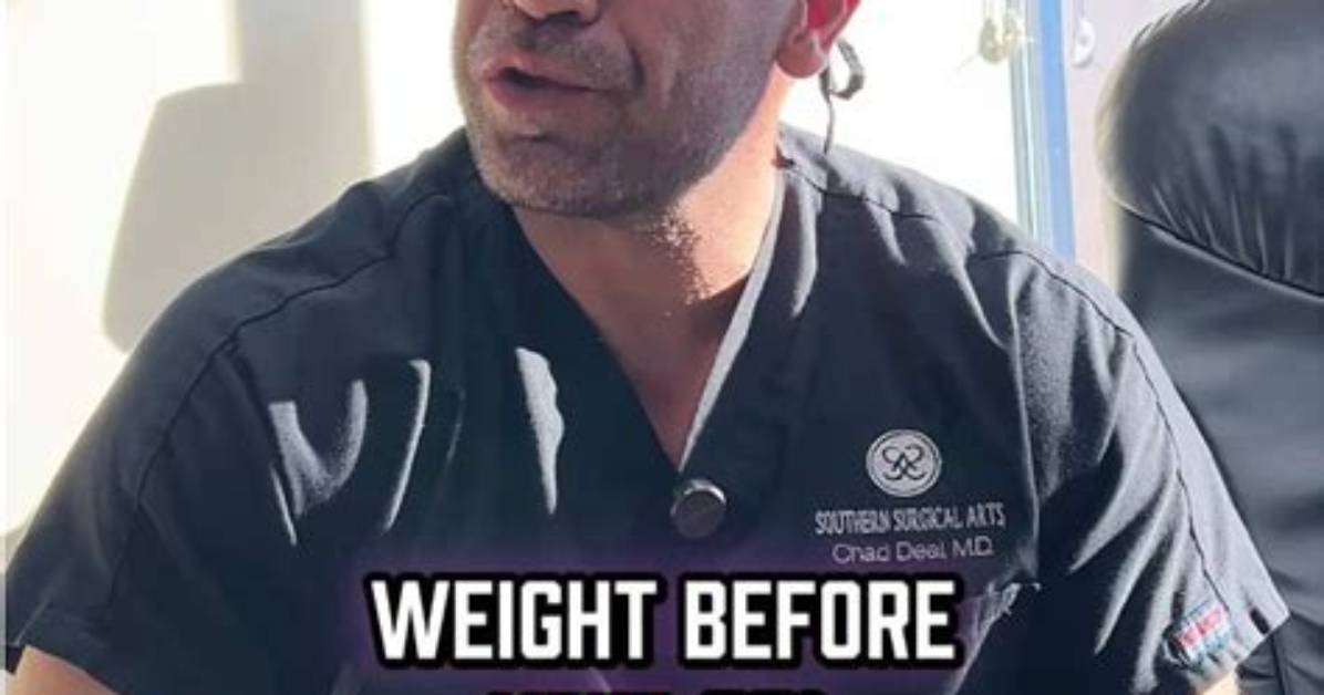 Should You Lose Weight Before Bbl?