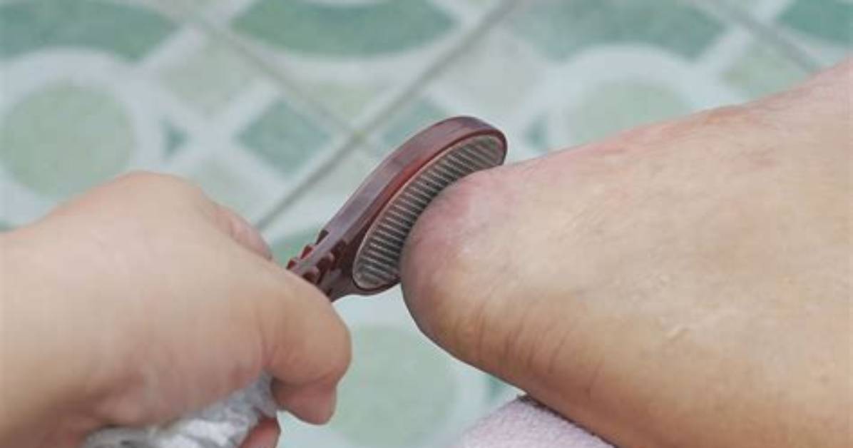 Should You Use Foot Scraper?