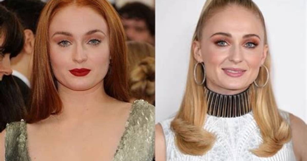 Sophie Turner Was Rumored to Have Plastic Surgery