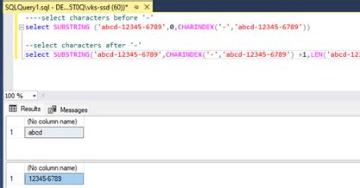 Sql Select Everything After Character