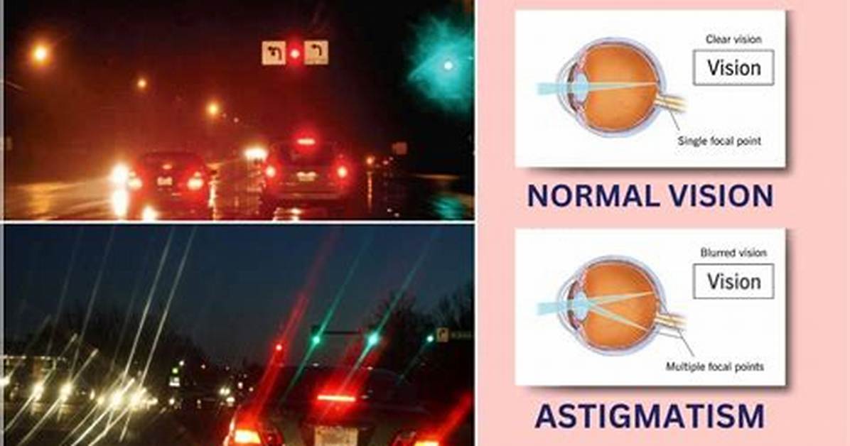 Stigmatism Definition