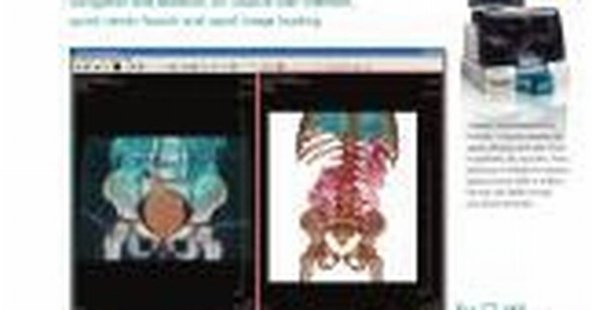 Substitute for Codonics Clarity Viewer?