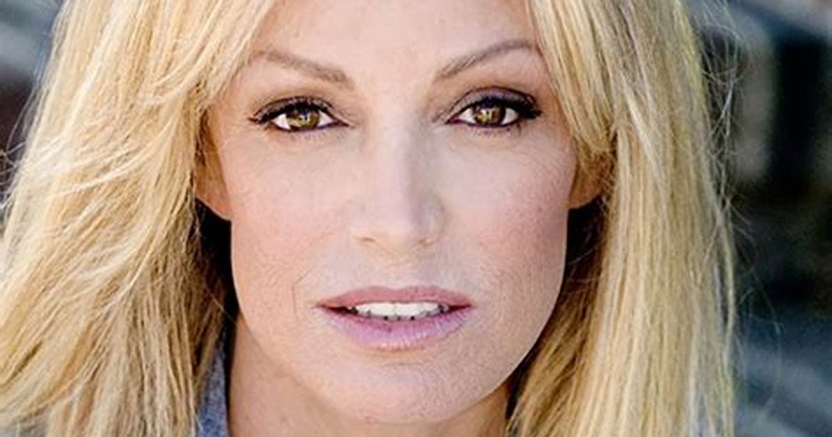 Susan Anton