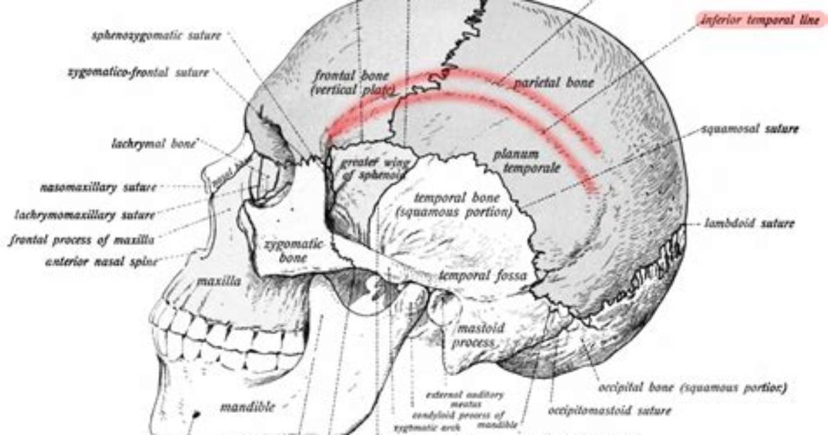 Temporal Lines