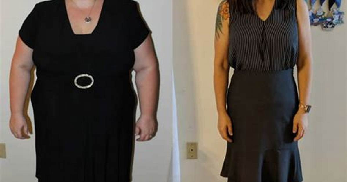 The Most Inspiring Gastric Bypass Before and After Photos