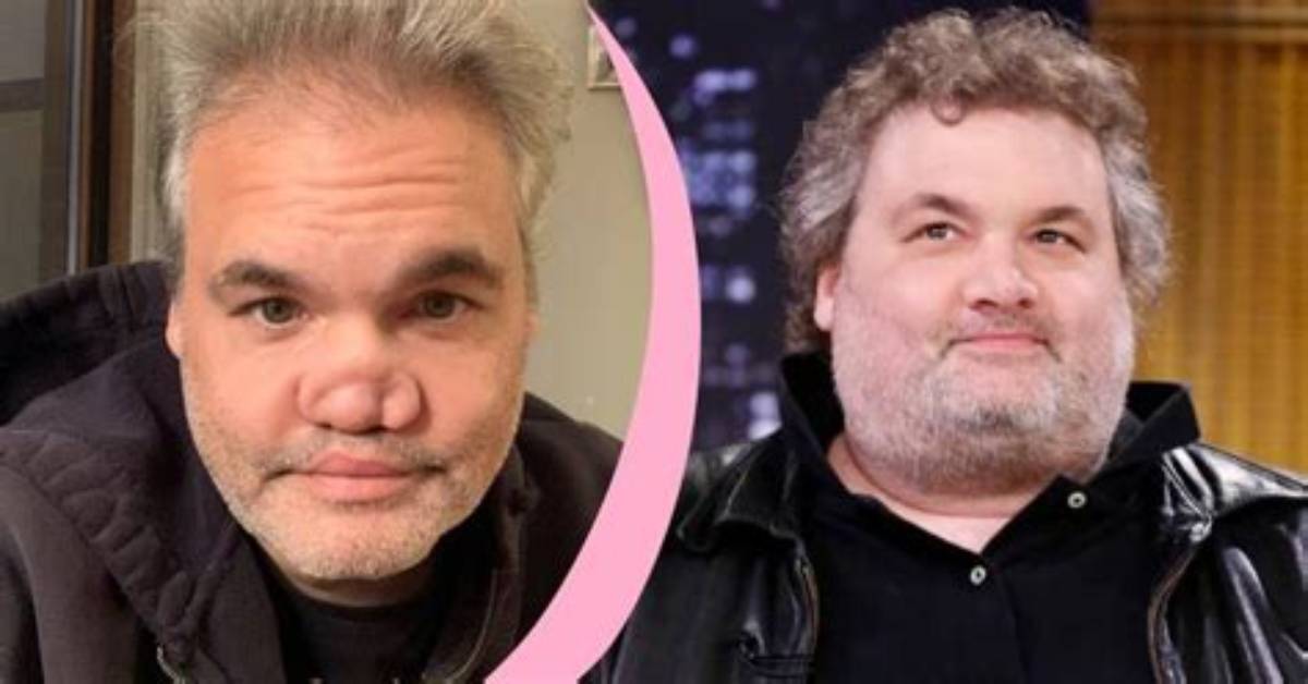 Understanding Artie Lange's Nose: a Deep Dive into His Journey and Transformation