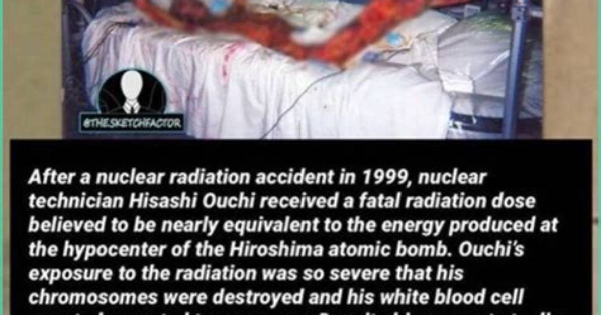 Understanding the Hisashi Nuclear Accident: Causes, Consequences, and Lessons Learned