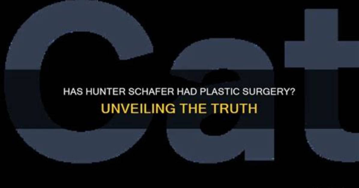 Unveiling the Truth: Has Hunter Schafer Had Surgery?