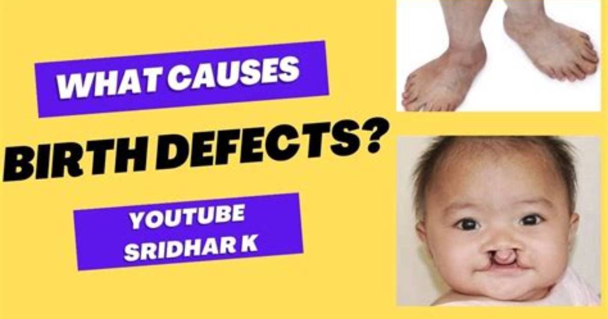 Was Born with Defects?
