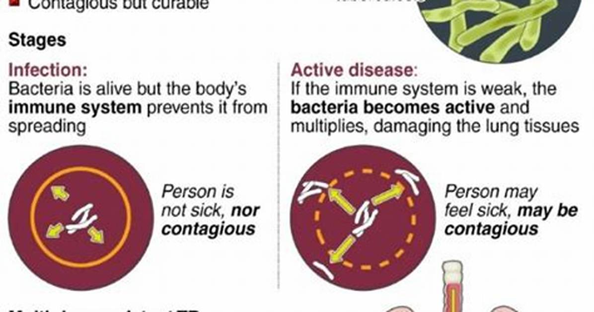 Was Consumption Really Tb?