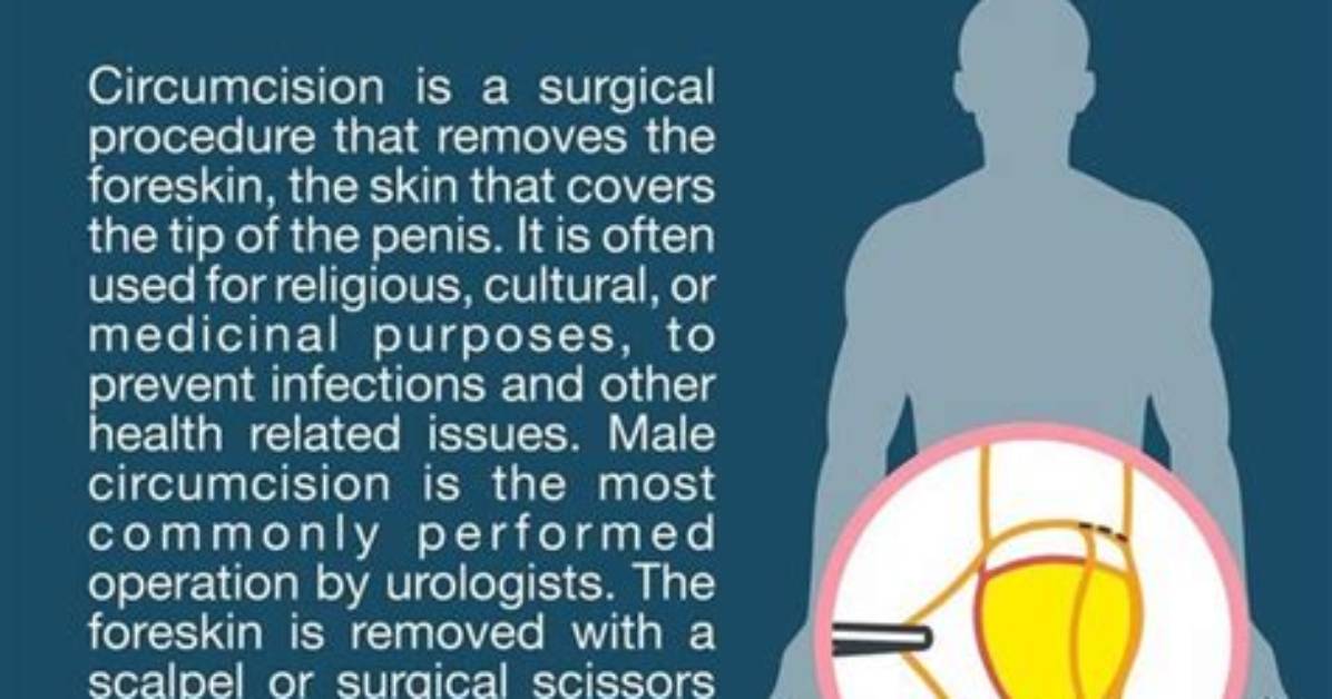Was Does Circumcision Mean?