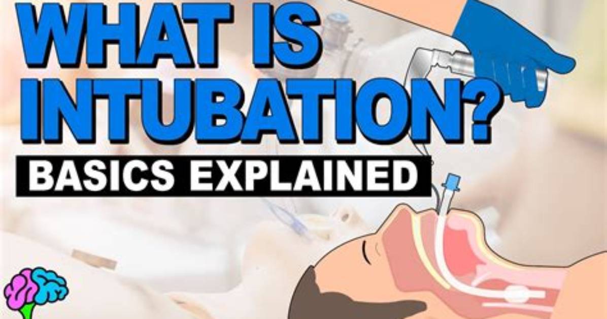 Was Does Intubated Mean?