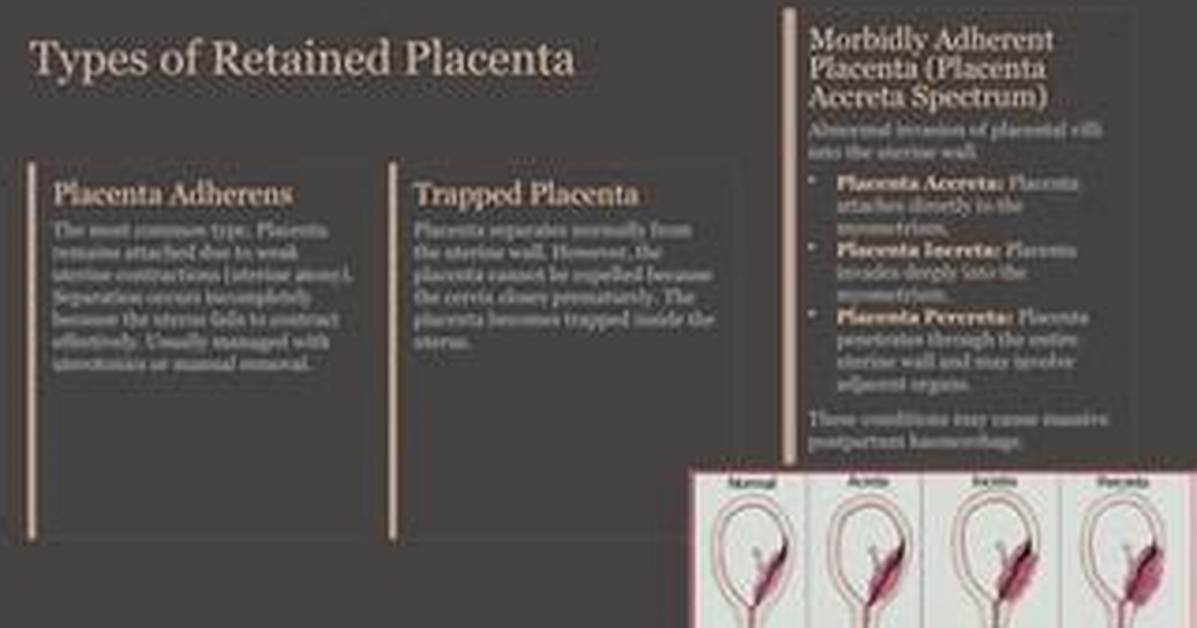Weak Placenta