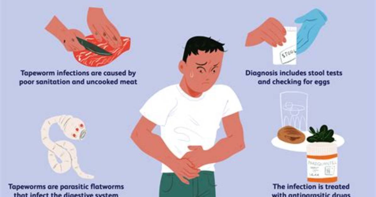 What a Tapeworm Feels Like