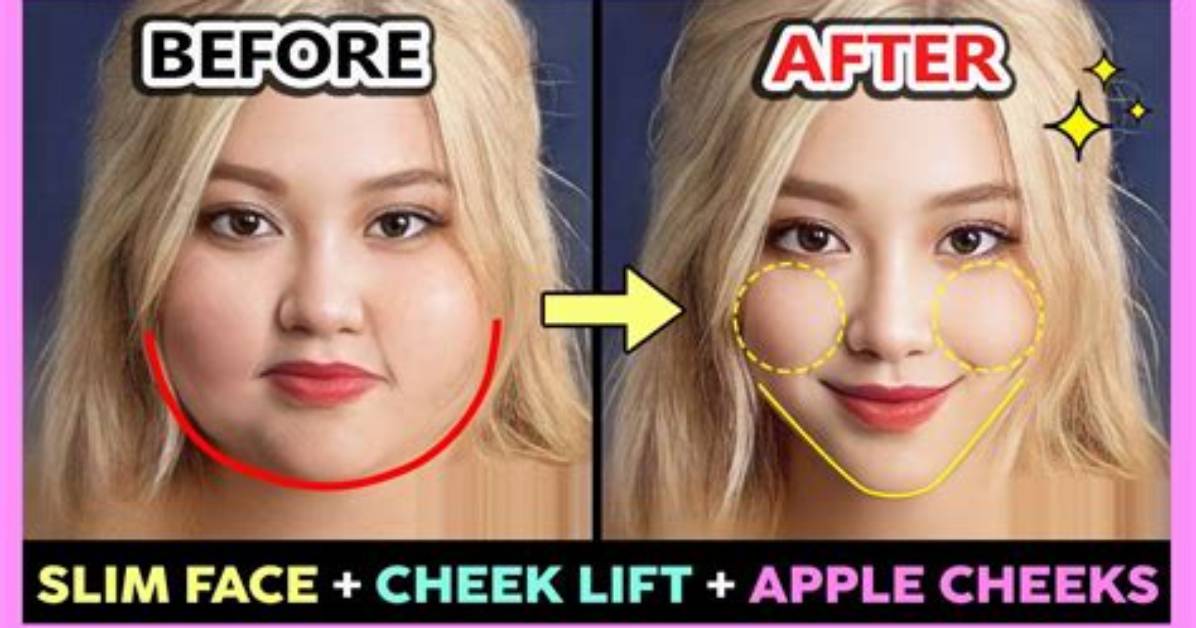 What Are Apple Cheeks?