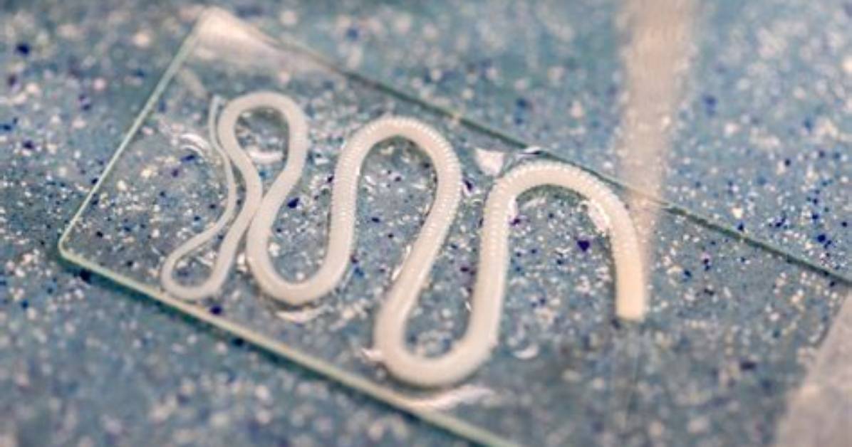 What Are Inside Worms