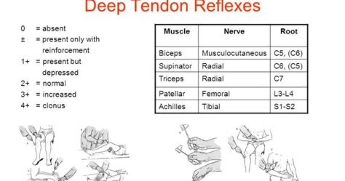 What Are Normal Deep Tendon Reflexes?