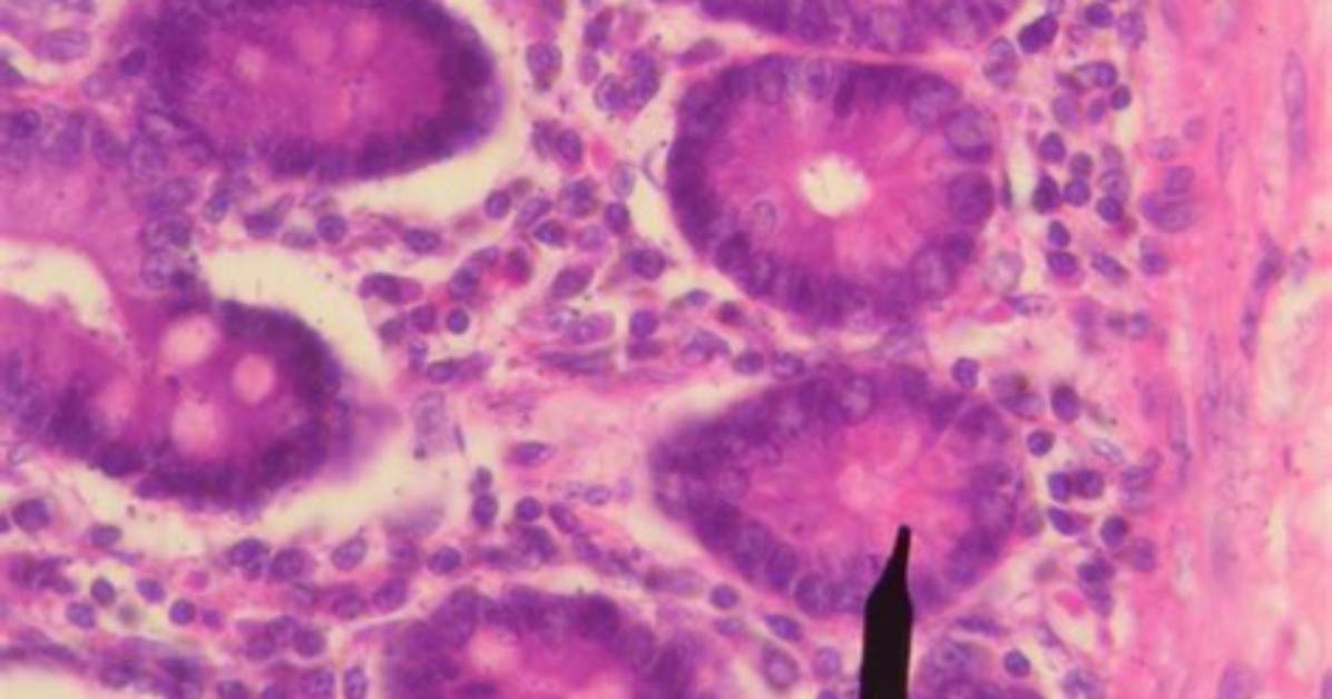 What Are Paneth Cells