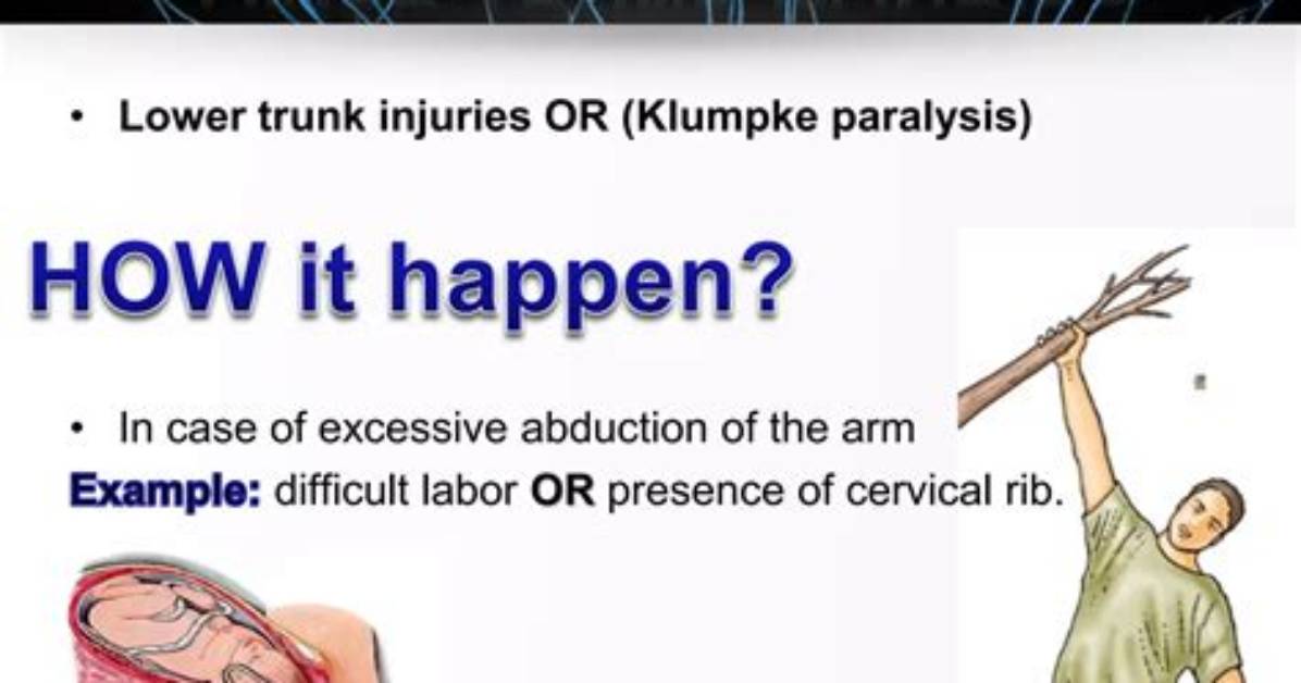 What Are Trunk Injuries