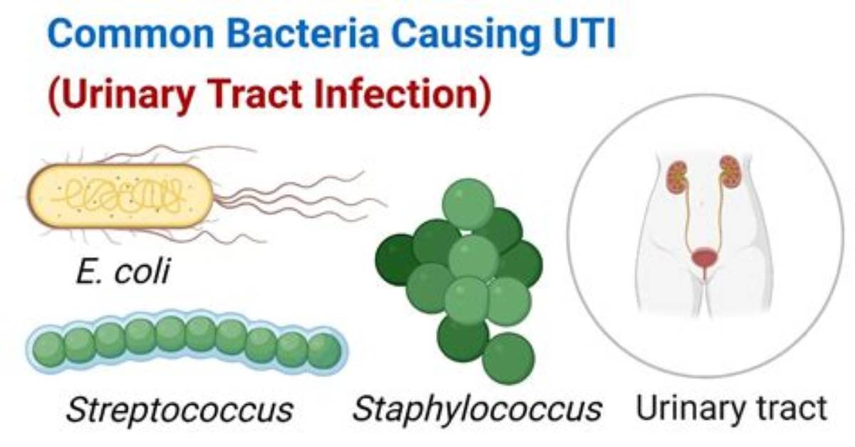 What Bacteria Causes a Uti?