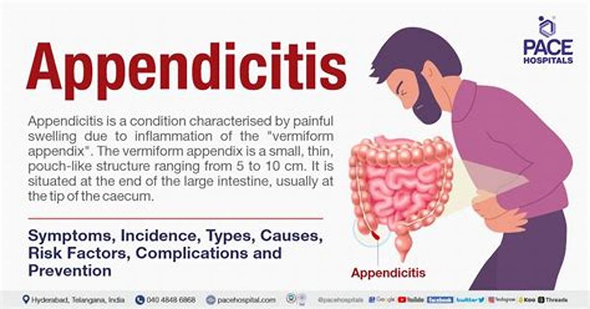 What Can Cause Appendicitis