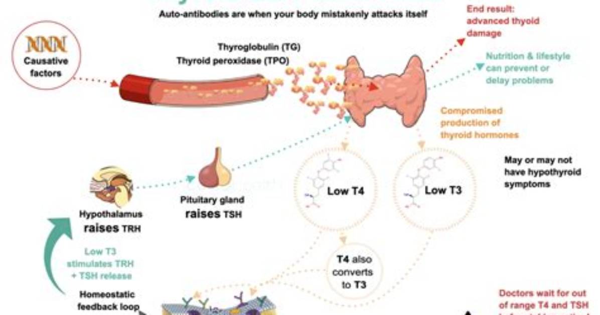 What Can Cause Elevated Thyroid Antibodies