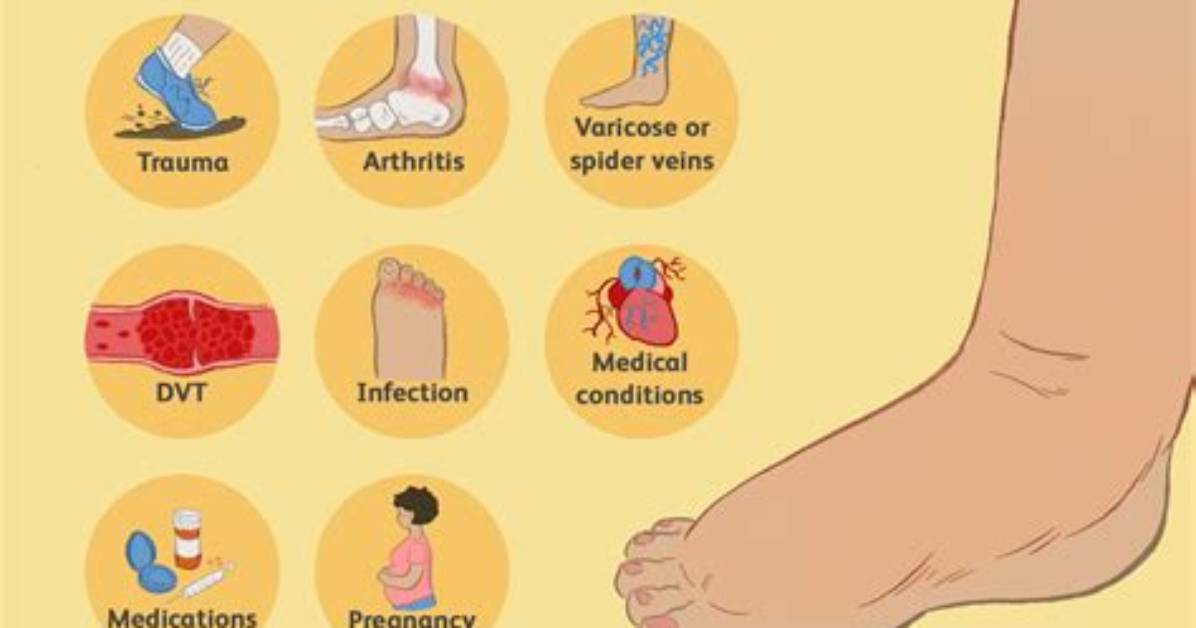 What Can Cause Swelling?